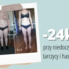 Metamorfoza: -24kg przy niedoczynności tarczycy i hashimoto. Zobacz, jak schudnąć, gdy tarczyca nie działa prawidłowo.