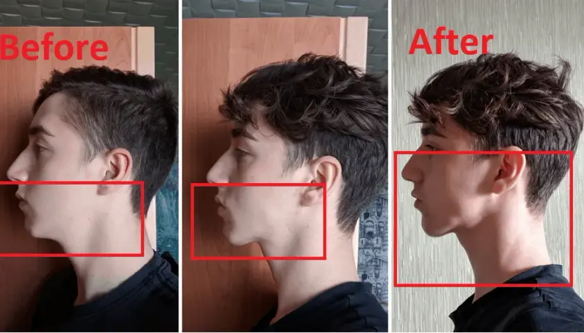 Jak ćwiczyć prawidłową pozycję spoczynkową języka dla zdrowia