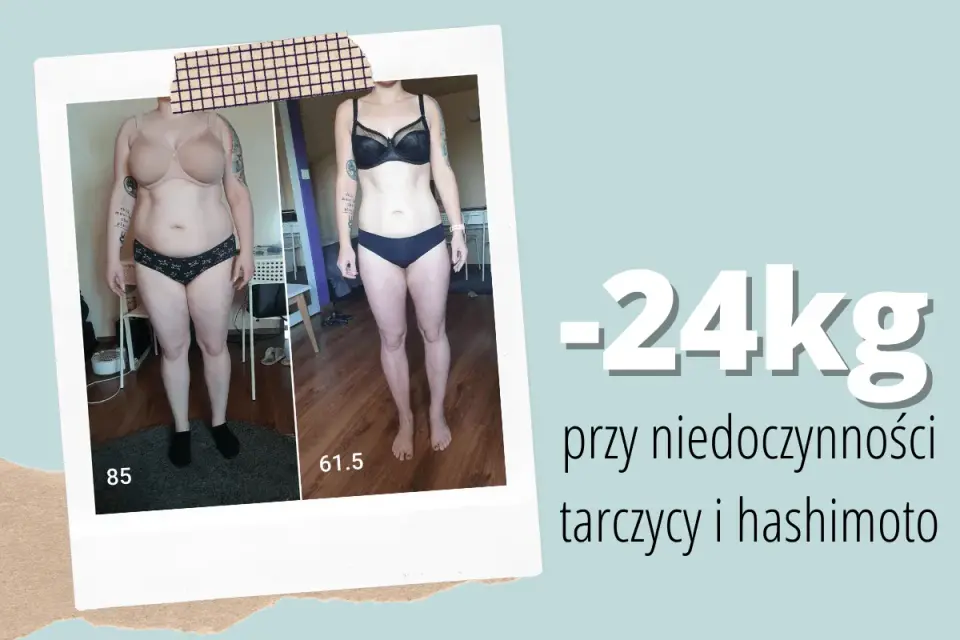Jak schudnąć przy niedoczynności tarczycy - Skuteczny plan